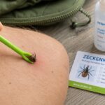 Wie entferne ich eine Zecke richtig?