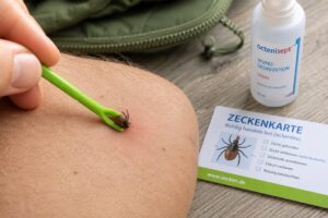 Wie entferne ich eine Zecke richtig?